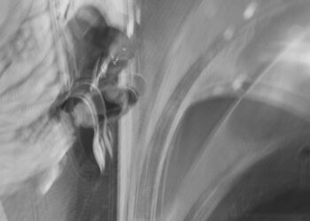 ANOUK MULDERS – Aandacht voor de ruis – Filmhuis Oosterbeek